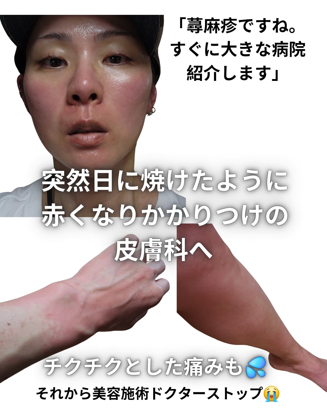 ドクダミLHAモイスチャーピーリングジェル/Anua/ピーリングを使ったクチコミ（2枚目）