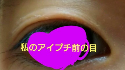 ナイトアイボーテ/StreeTrend/二重まぶた用アイテムを使ったクチコミ(4枚目)