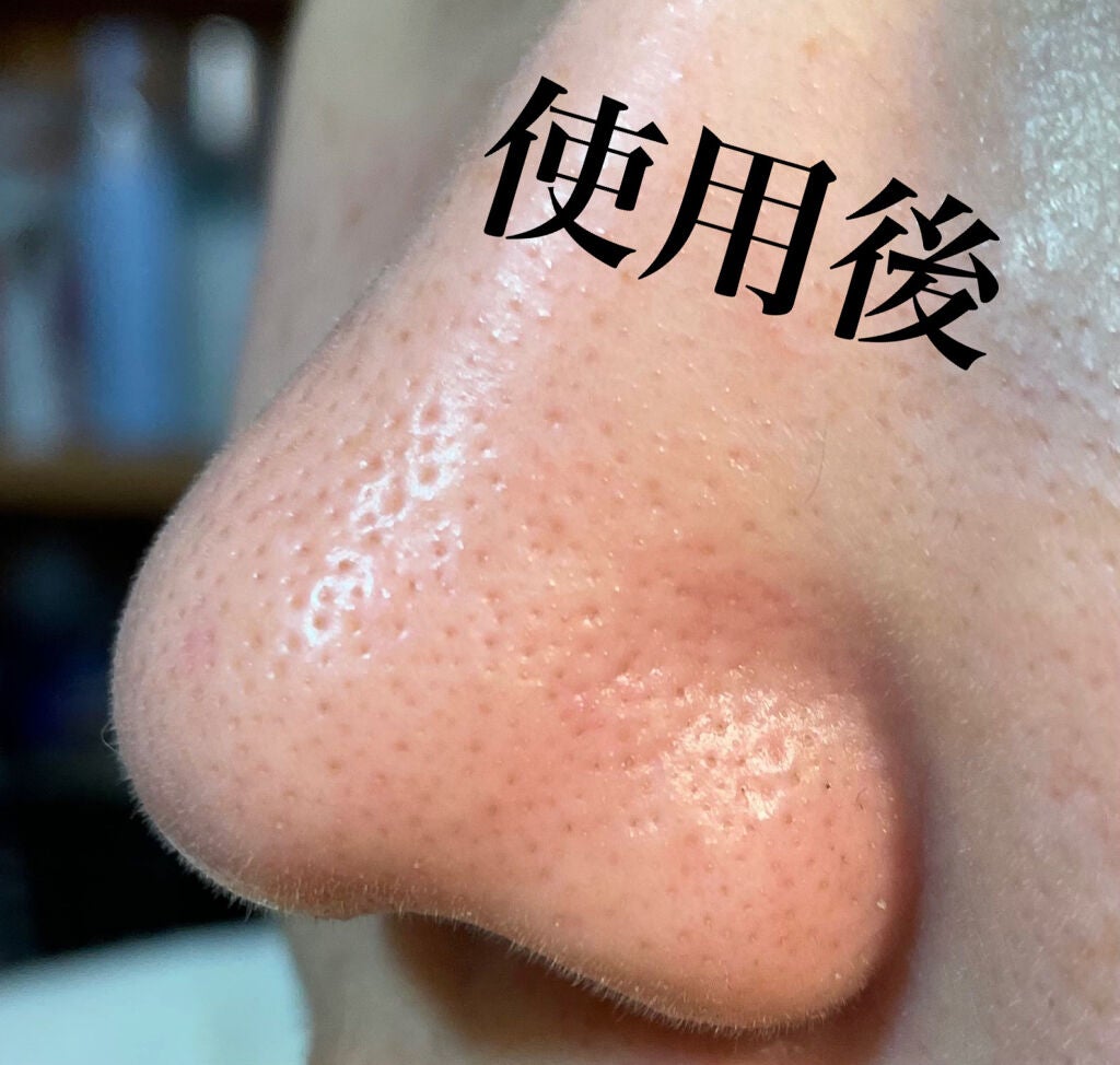 デュオ ザ クレンジングバーム ブラック/DUO/クレンジングバームを使ったクチコミ(3枚目)