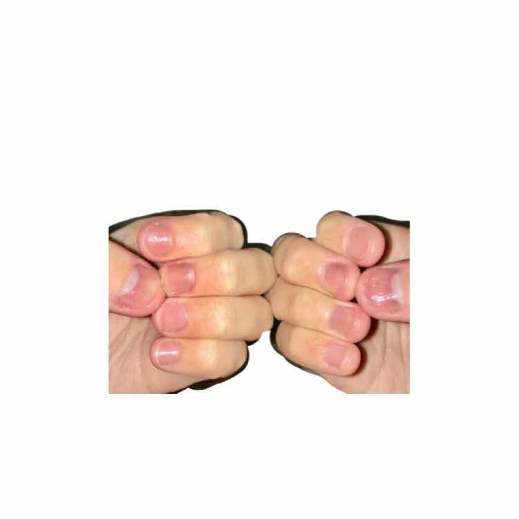 ネイルケアオイル/無印良品/ネイルオイル・トリートメントを使ったクチコミ(2枚目)