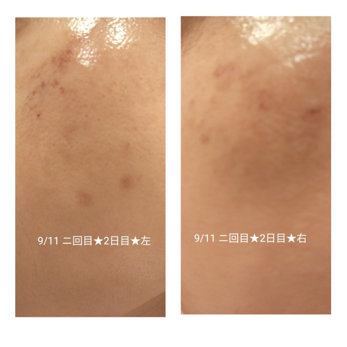 を使ったクチコミ（2枚目）