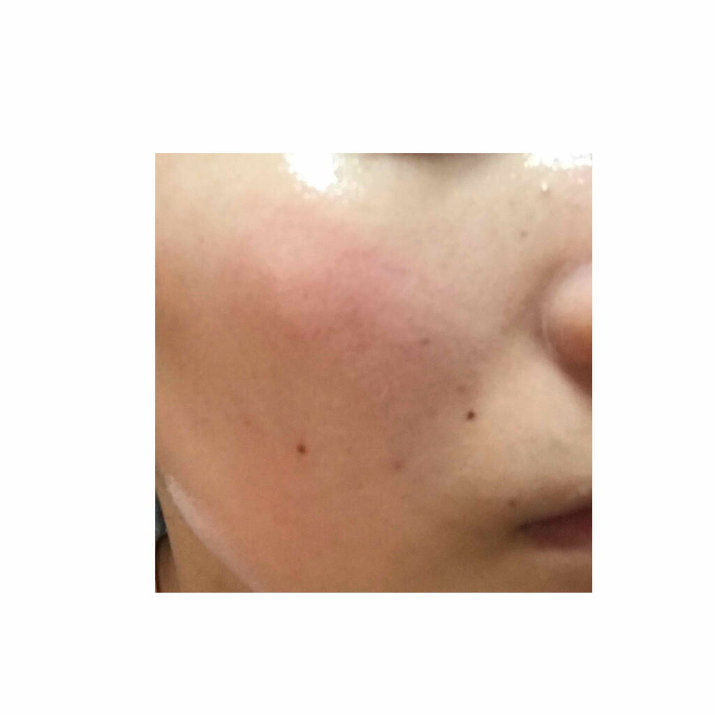 ハトムギ化粧水(ナチュリエ スキンコンディショナー R )/ナチュリエ/化粧水を使ったクチコミ（2枚目）