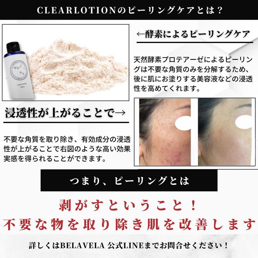 BELA VELA on LIPS 「ふき取るだけ。おうちでプロのピーリング『WHITINACLEA..」(3枚目)
