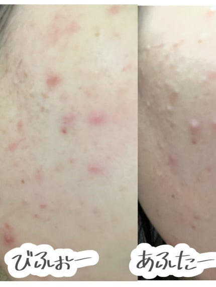 シカプラス ディープモイスチャーマスク/G9SKIN/シートマスク・パックを使ったクチコミ(4枚目)