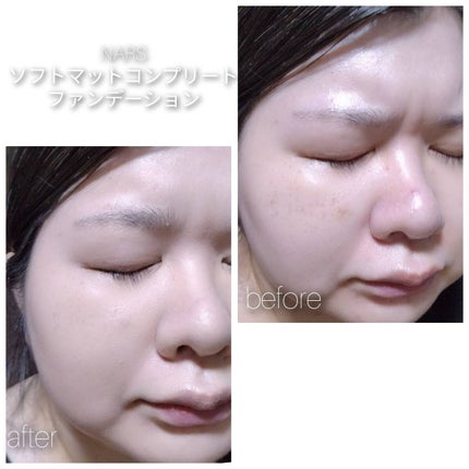 ソフトマットコンプリート ファンデーション/NARS/リキッドファンデーションを使ったクチコミ(4枚目)