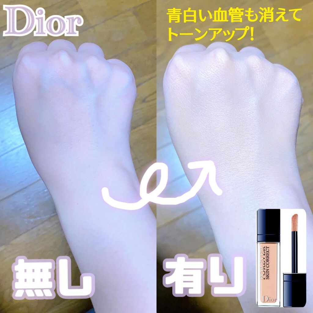 【旧】ディオールスキン フォーエヴァー スキン コレクト コンシーラー/Dior/リキッドコンシーラーを使ったクチコミ（1枚目）