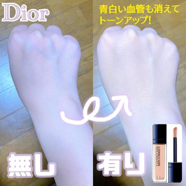 【旧】ディオールスキン フォーエヴァー スキン コレクト コンシーラー/Dior/コンシーラーを使ったクチコミ（1枚目）