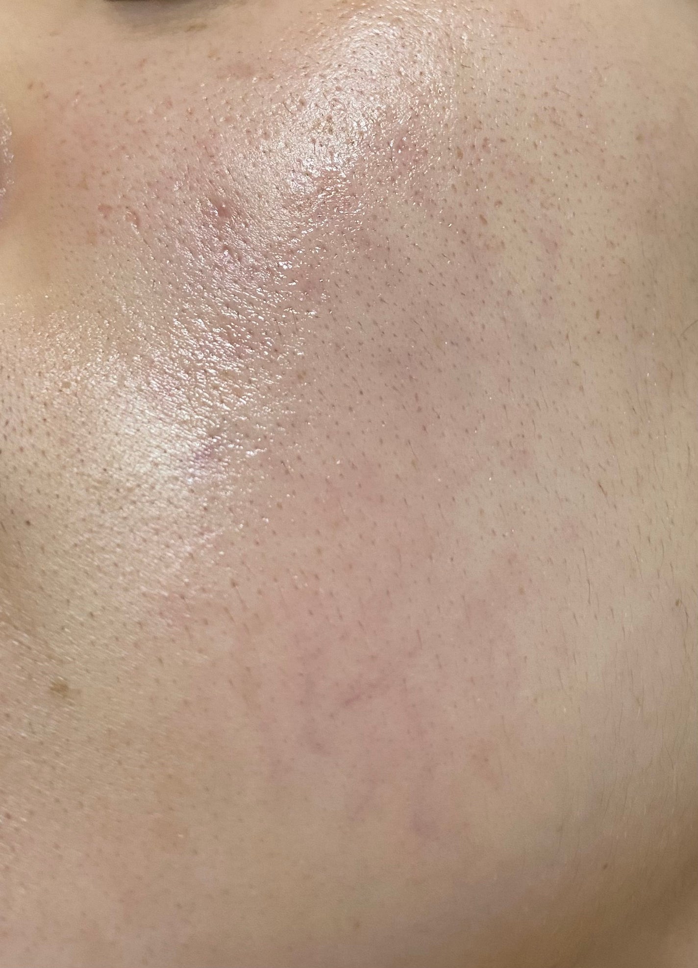 Rエッセンス/unlabel/美容液を使ったクチコミ(1枚目)