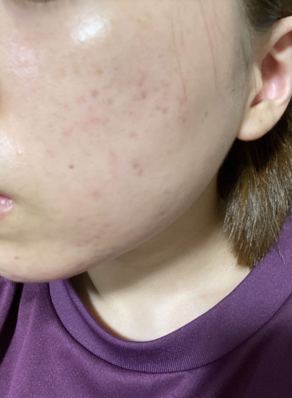 コンセントレート インジュビネーション マスク/ジュレリッチ/シートマスク・パックを使ったクチコミ（3枚目）