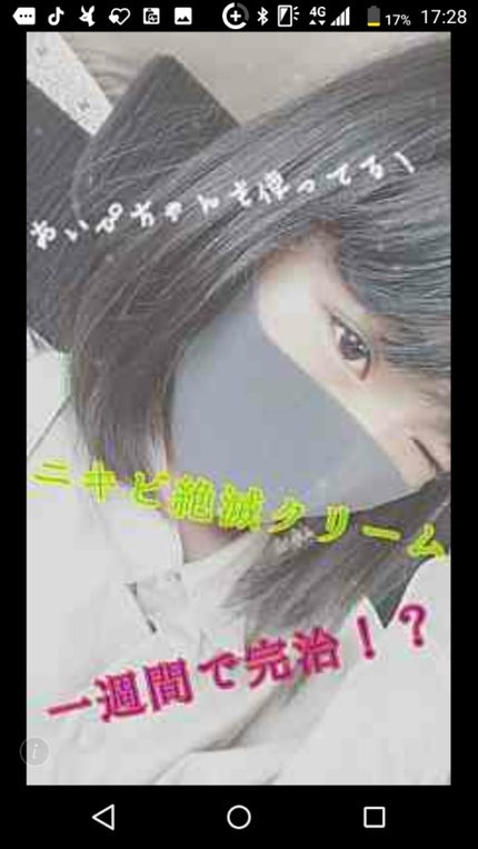 ヘパリン類似物質 油性クリーム0.3%「日医工」/日医工ファーマ/その他スキンケアを使ったクチコミ(1枚目)
