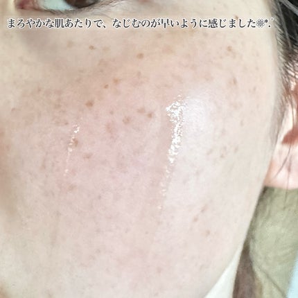 センテラ アンプル/SKIN1004/美容液を使ったクチコミ(4枚目)