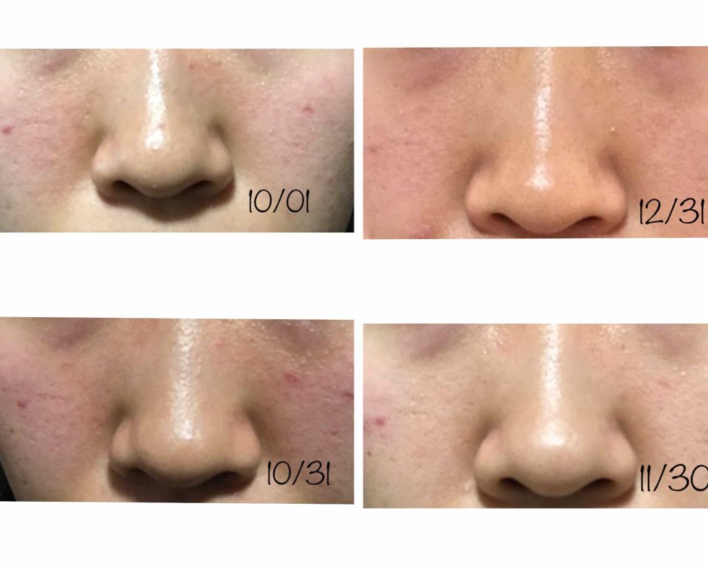 ウォッシャブル コールド クリーム/ちふれ/クレンジングクリームを使ったクチコミ(2枚目)