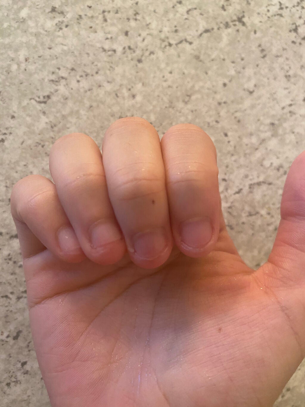 星 on LIPS 「爪日記何日かぶりか目サボっていたらこんなことになってしまいまし..」(1枚目)