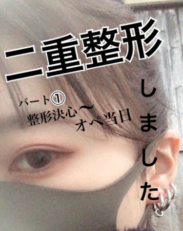 二重整形について
2020.10.10に二重整形を行いました

理由としましては二重にしないと外に出ることができず、スッピンで外出することなんてとても出来ませんでした。
またアイプチのせいでやりたいアイ