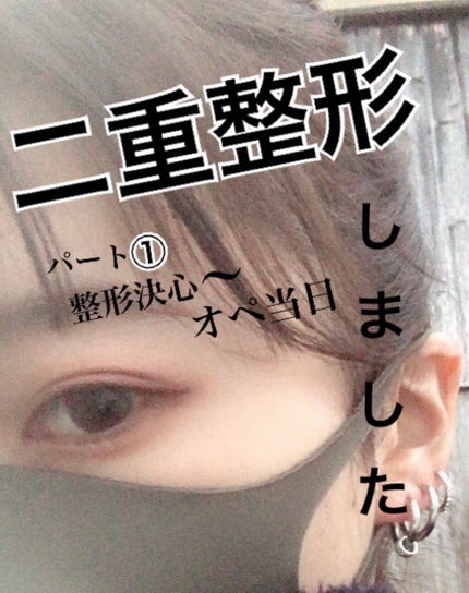 二重整形/その他を使ったクチコミ(1枚目)
