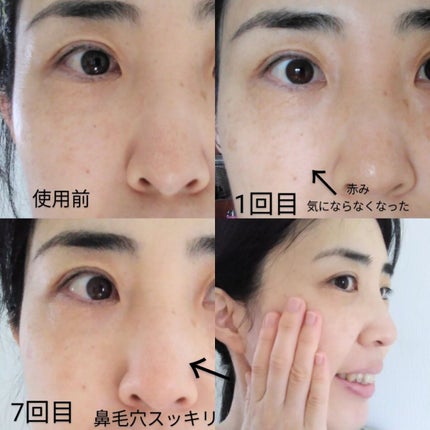 を使ったクチコミ(2枚目)
