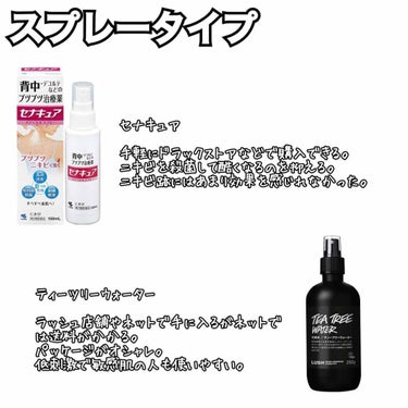 メンソレータム アクネス 薬用パウダー化粧水のクチコミ「通年背中ニキビに悩まされて来ました。

もーあきらめモードでした

でも海に行けるのも若い時期.....」（2枚目）