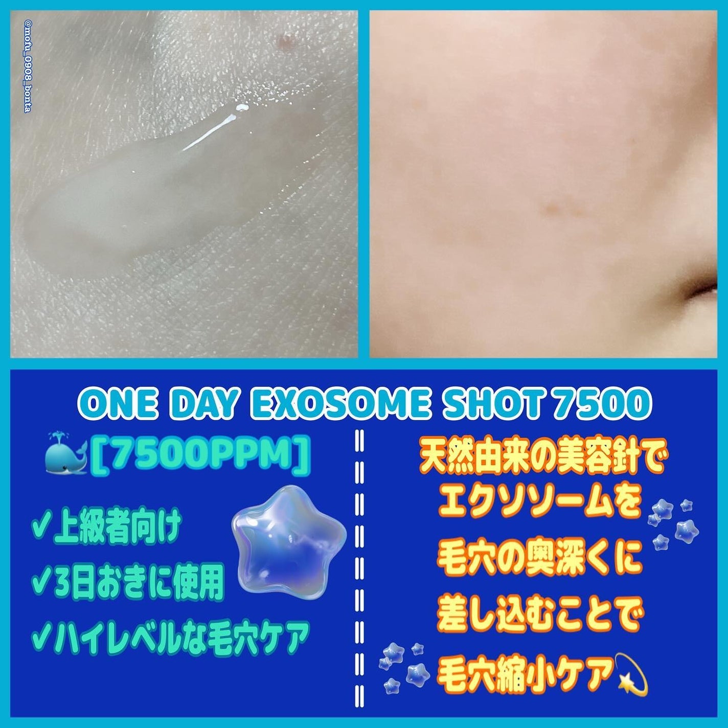 ゼロ毛穴パッド 2.0/MEDICUBE/トナーパッドを使ったクチコミ(7枚目)