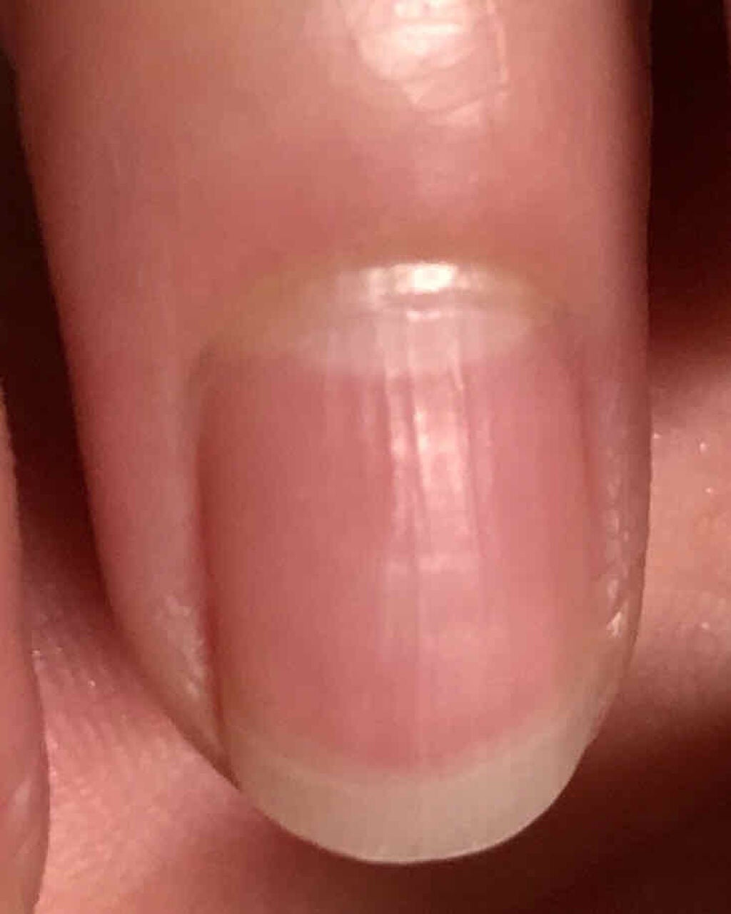 爪ミガキセット/デュカート/ネイル用品を使ったクチコミ(2枚目)