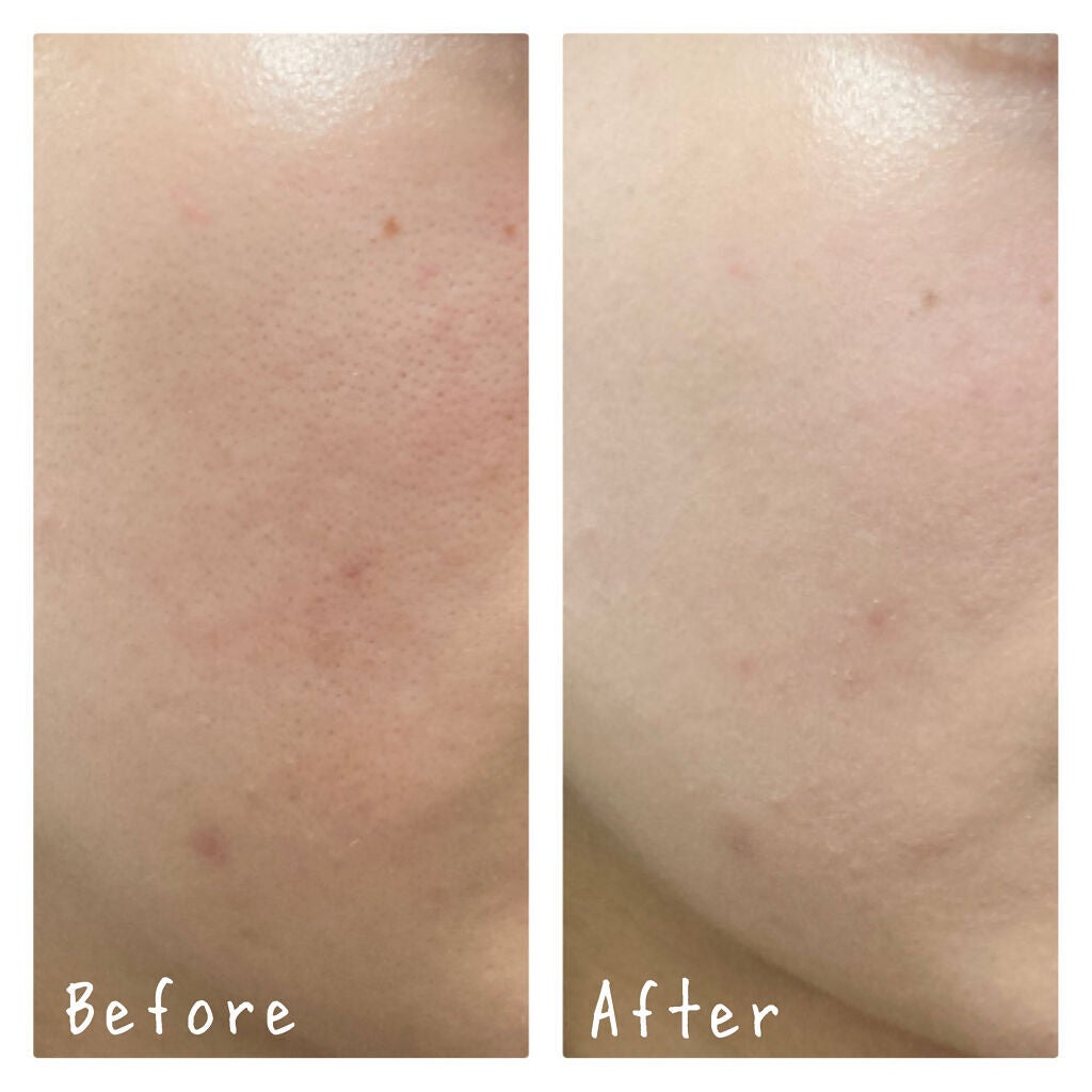 ピーチスキンフィッティングベース/espoir/化粧下地を使ったクチコミ(3枚目)