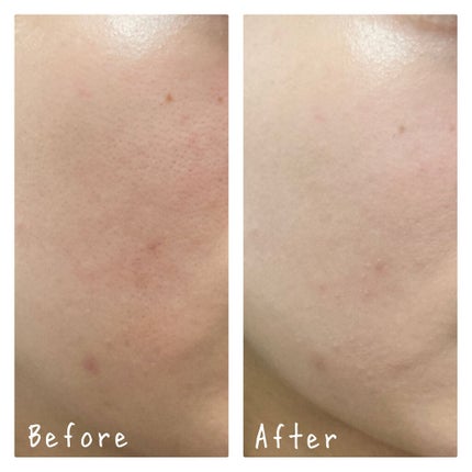 ピーチスキンフィッティングベース/espoir/化粧下地を使ったクチコミ(3枚目)