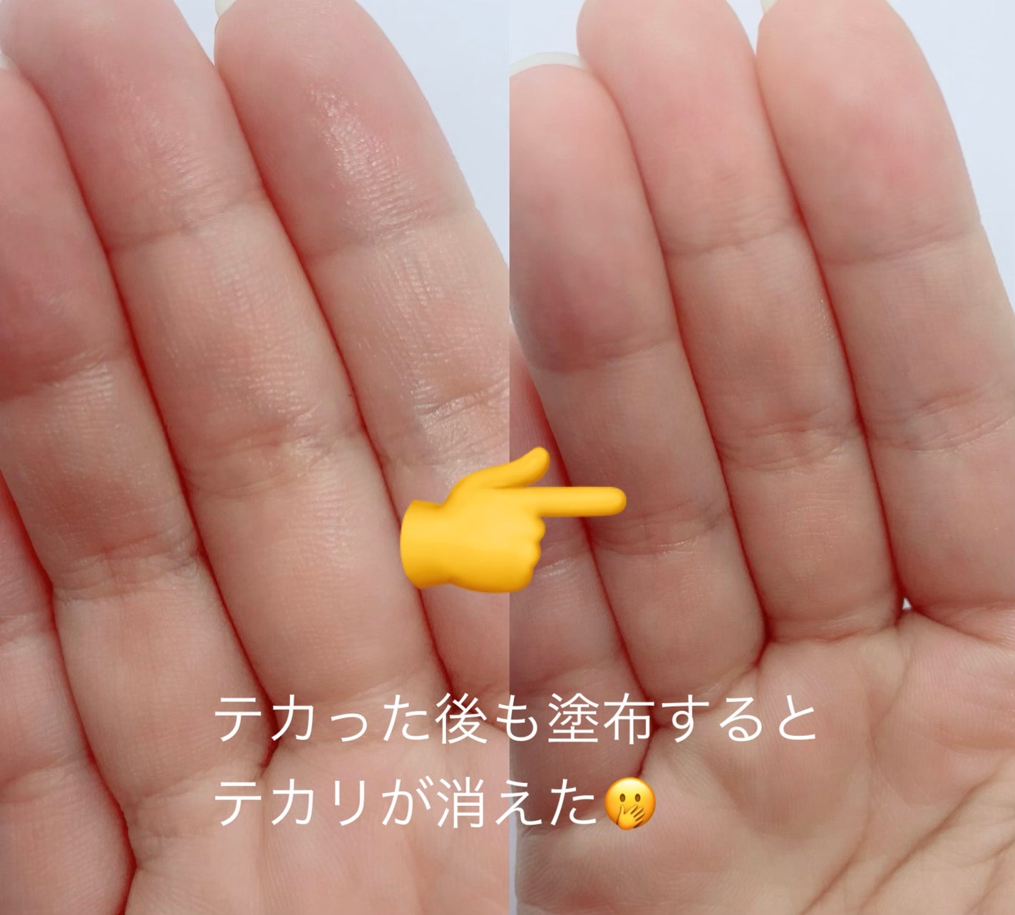 オイルコントロールカプセルエッセンス/celimax/美容液を使ったクチコミ(3枚目)