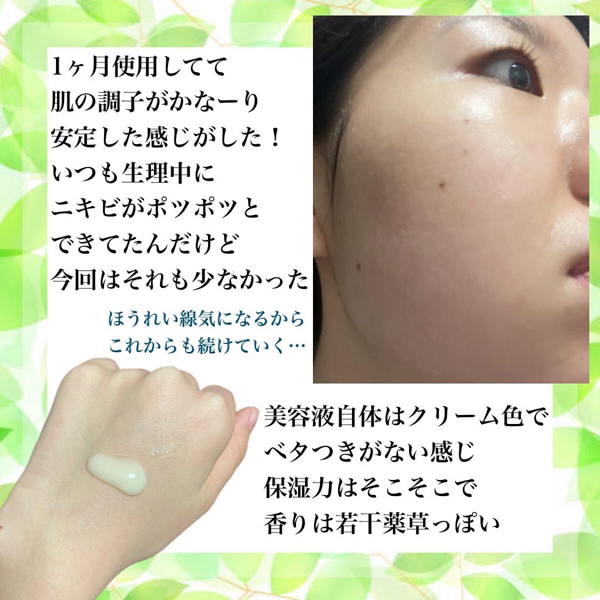 レチノール シカ リペア セラム/innisfree/美容液を使ったクチコミ(3枚目)