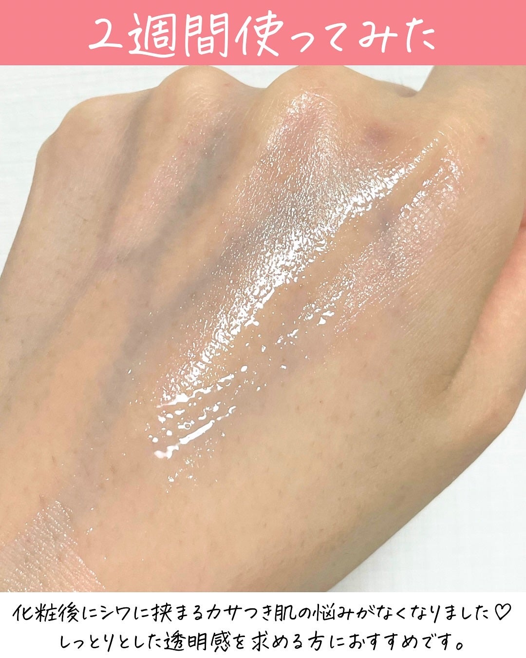 リマージ糸リフティングアンプル/REVENIP/美容液を使ったクチコミ(5枚目)