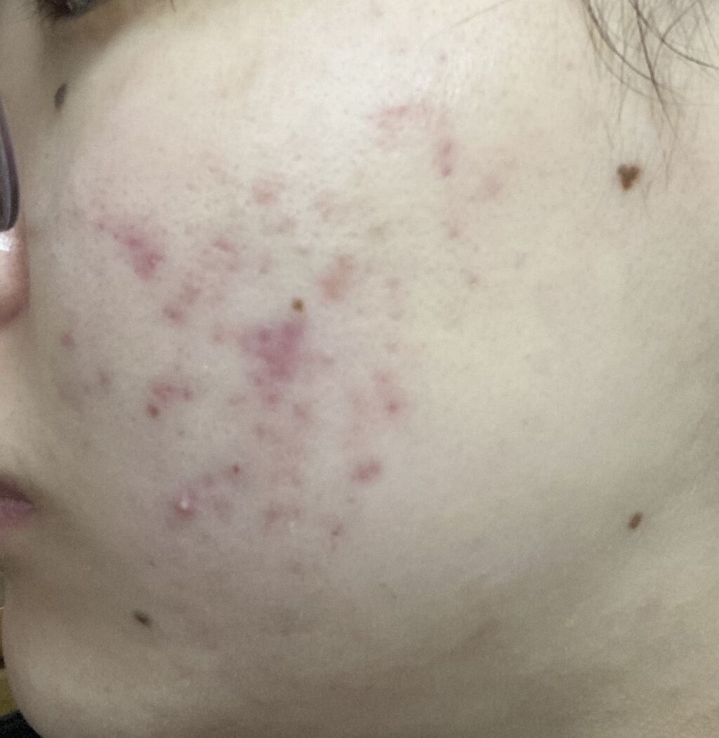 保湿クリーム /ちふれ/フェイスクリームを使ったクチコミ（1枚目）