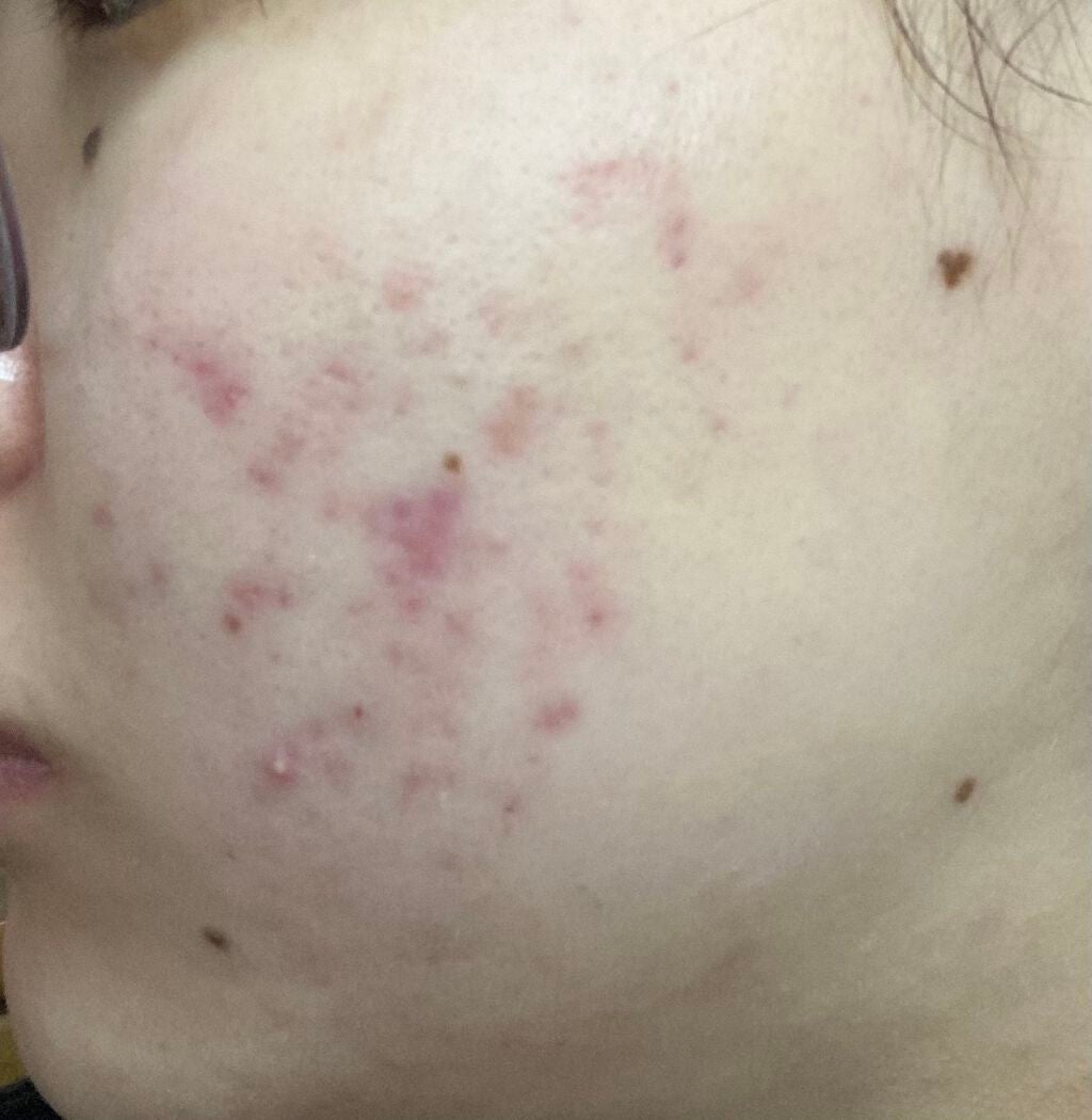 保湿クリーム /ちふれ/フェイスクリームを使ったクチコミ(1枚目)