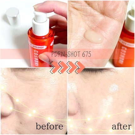 PDRNショット675/COSNORI/美容液を使ったクチコミ(3枚目)