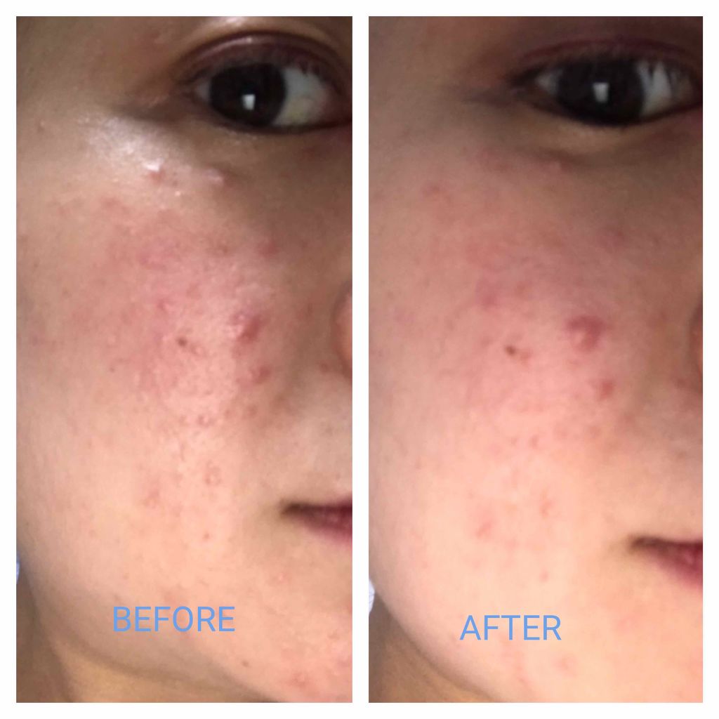 ラ プードル オートニュアンス/Elégance/プレストパウダーを使ったクチコミ(4枚目)