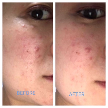 ラ プードル オートニュアンス/Elégance/プレストパウダーを使ったクチコミ(4枚目)