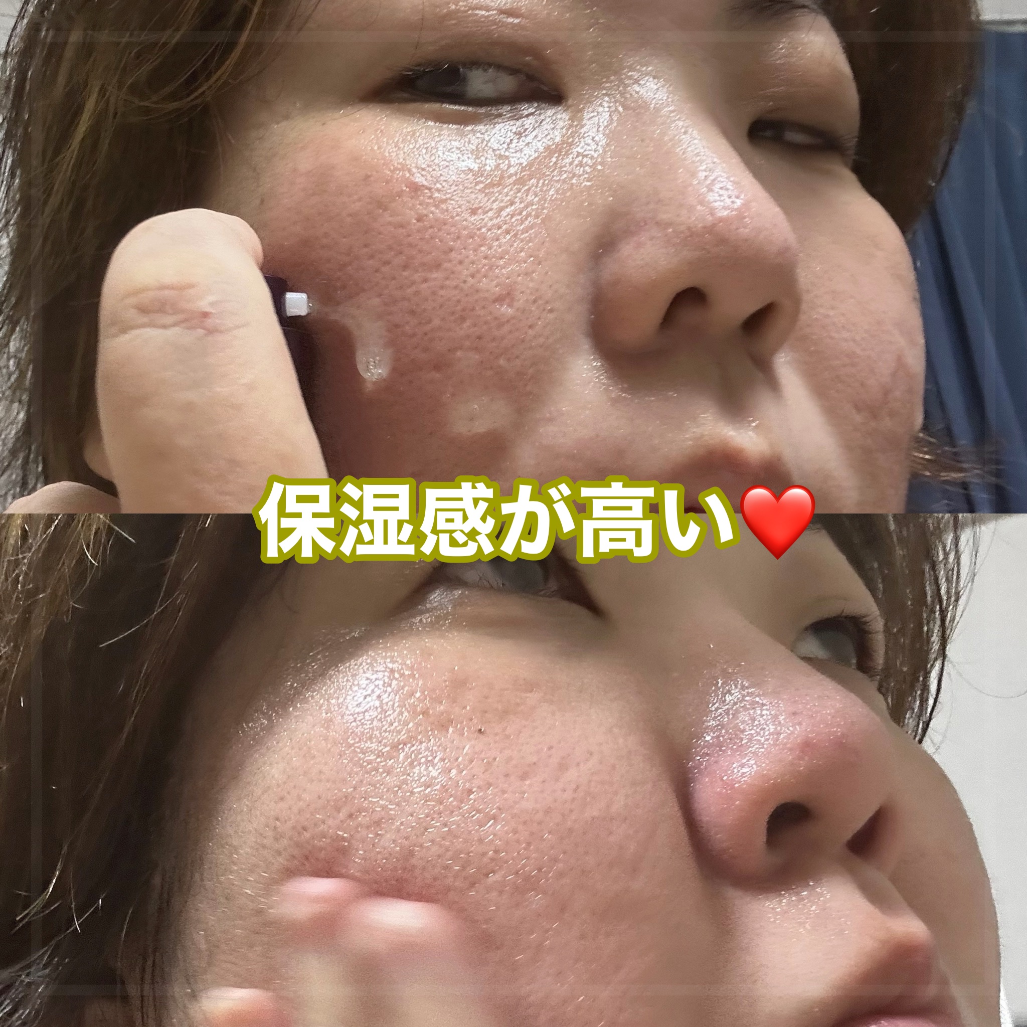 アミノ酸アンプル/dixionist/美容液を使ったクチコミ（2枚目）