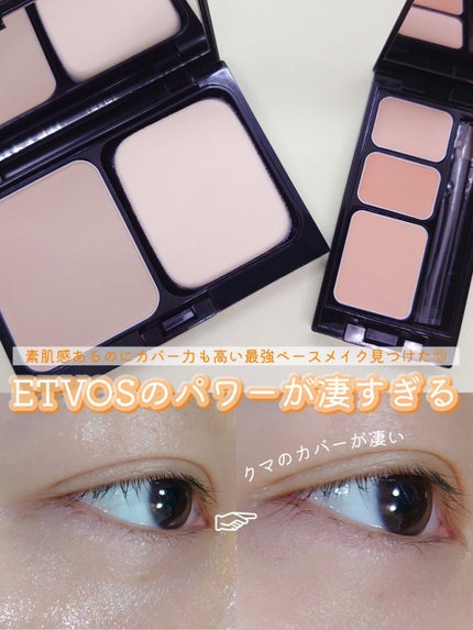 ミネラルコンシーラーパレット/エトヴォス/パレットコンシーラーを使ったクチコミ(1枚目)