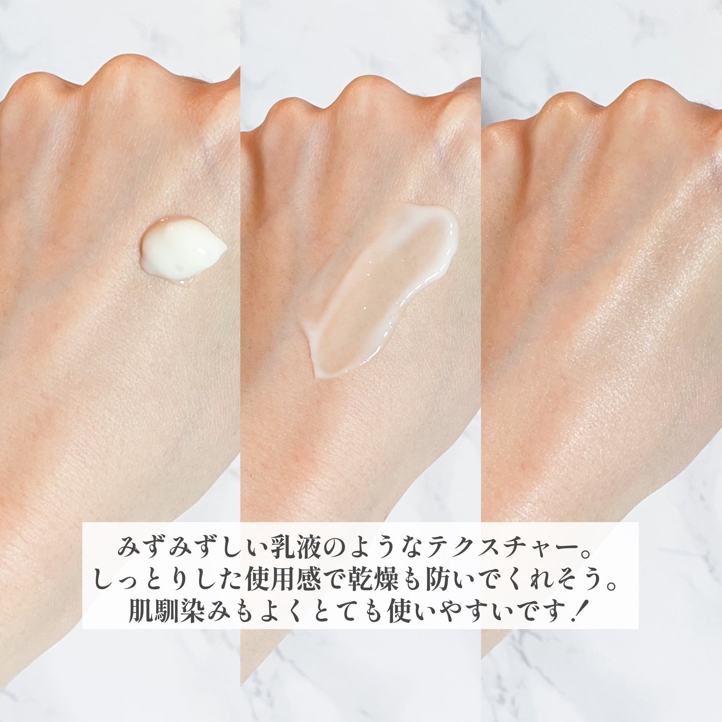 ボタレチノールユースリペアソリューションセット/ENPRANI(韓国)/美容液を使ったクチコミ(4枚目)