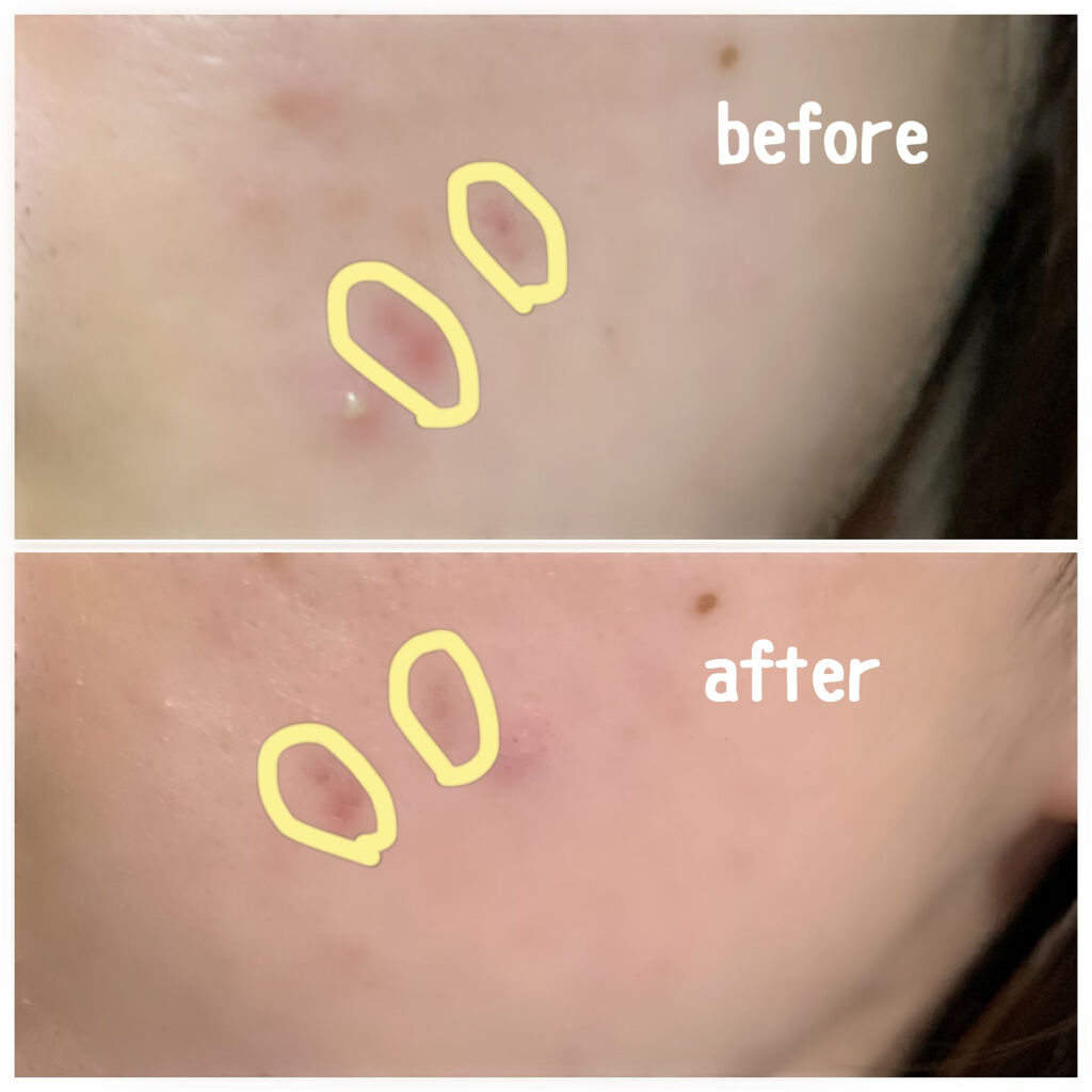 白色ワセリン(医薬品)/健栄製薬/その他を使ったクチコミ（2枚目）