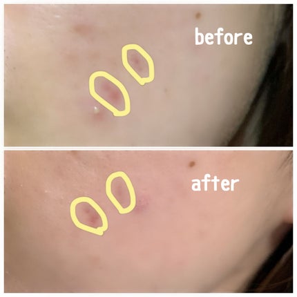 白色ワセリン(医薬品)/健栄製薬/その他を使ったクチコミ(2枚目)