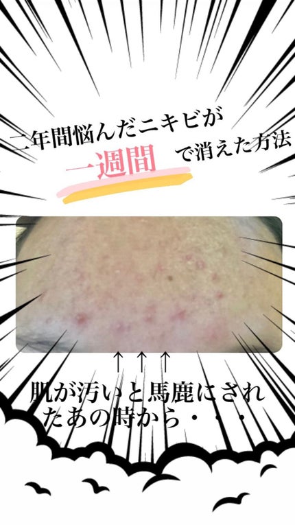 Uちゃん on LIPS 「美顔水(化粧水)130年以上続く超ロングセラー!匂いがツーンと..」(1枚目)