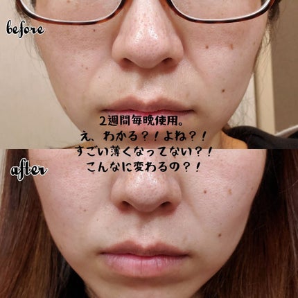 プロバイオダーム リフティング クリーム/BIOHEAL BOH/フェイスクリームを使ったクチコミ(8枚目)