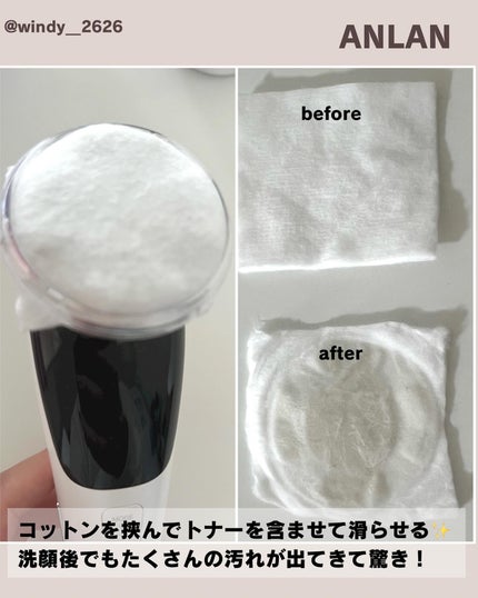 多機能温冷美顔器/ANLAN/美顔器・マッサージを使ったクチコミ(6枚目)