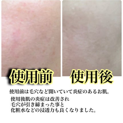 リードルショット300/VT/美容液を使ったクチコミ(4枚目)