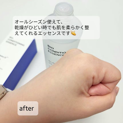 バイオ コンディショニング エッセンス/IOPE/ブースター・導入液を使ったクチコミ(3枚目)