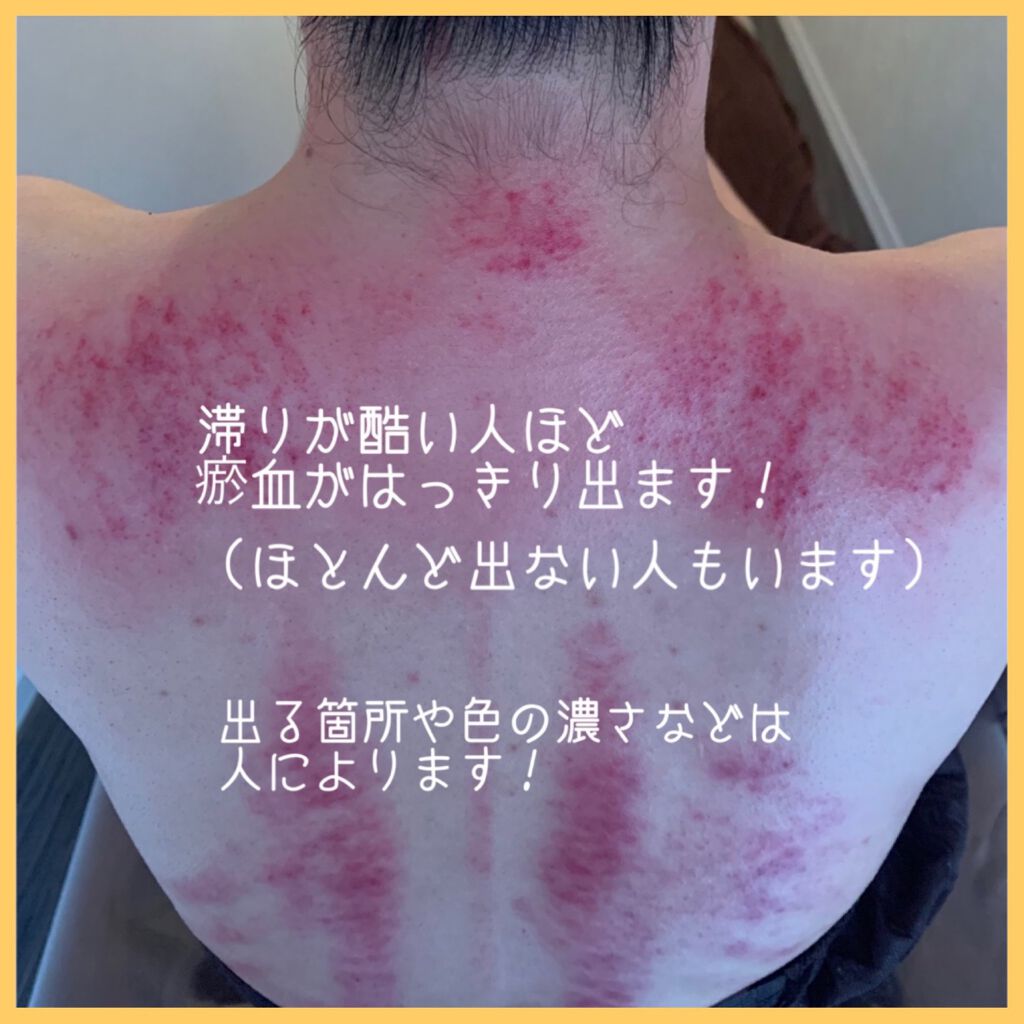 を使ったクチコミ（3枚目）