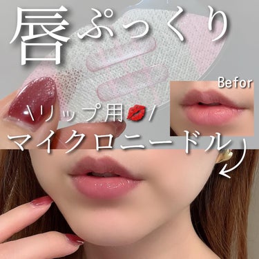 MOTTO LAB. LIPS SHOTのクチコミ「お家で簡単❣️リップ用マイクロニードル✨
⁡
マイクロニードルを世界ではじめて*1開発したコス.....」（1枚目）