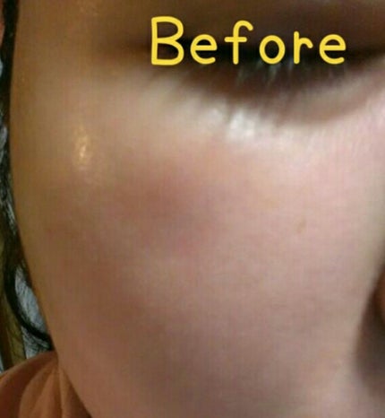 ラッシュ ショコラのこだわりのクチコミ「#敏感肌 の方注意!◤◢◤◢注意◤◢◤◢
ショコラのこだわりを2個目リピートした所ニキビが口周.....」(3枚目)