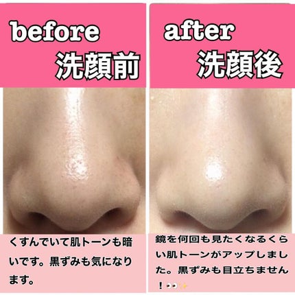 PINK BRIGHTENING CLEANSER/KIM SOHYUNG BEAUTY/オールインワン化粧品を使ったクチコミ(9枚目)