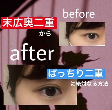 奥二重の私が4年間かけて見つけた
絶対！ぱっちり二重になる方法💕

説明だけみたい方は飛ばしてください🙇‍♀️


｡oＯo｡.:♥:.｡oＯo｡.:♥:.｡oＯo｡.:♥:.｡oＯo｡.:♥:.
こん