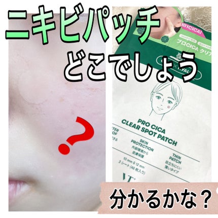 プロCICA クリアスポットパッチ/VT/その他スキンケアを使ったクチコミ(1枚目)