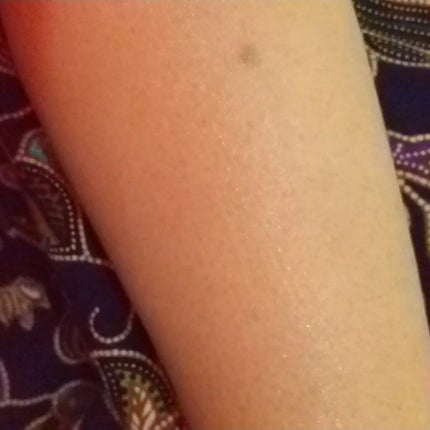 タカミスキンピールボディ/タカミ/ボディローションを使ったクチコミ(4枚目)